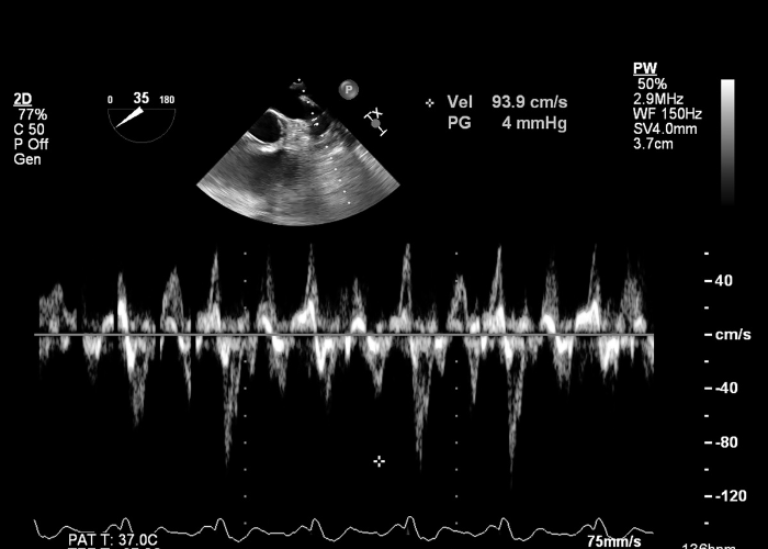 a screen shot of an ultrasound